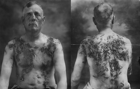 John_Meintz,_punished_during_World_War_I_-_NARA_-_283633_-_restored